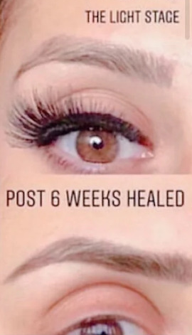 Navigating the Microblading Healing Process